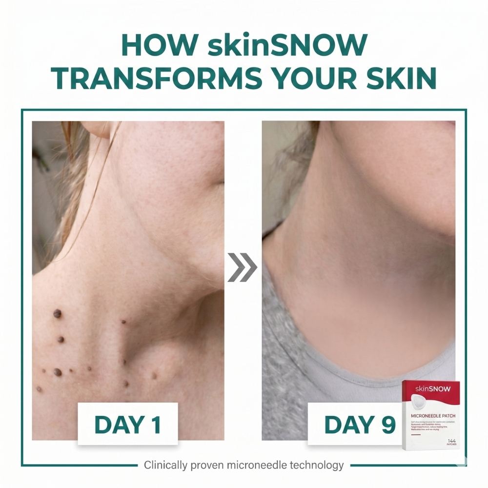 SkinSNOW - Patches For Skin