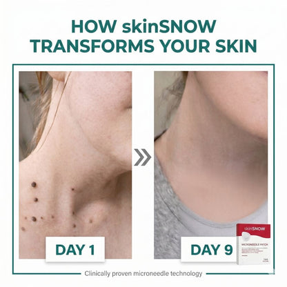 SkinSNOW - Patches For Skin