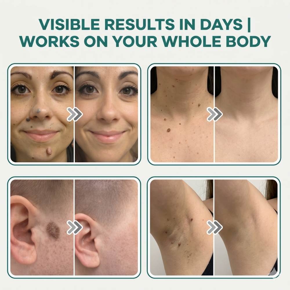 SkinSNOW - Patches For Skin