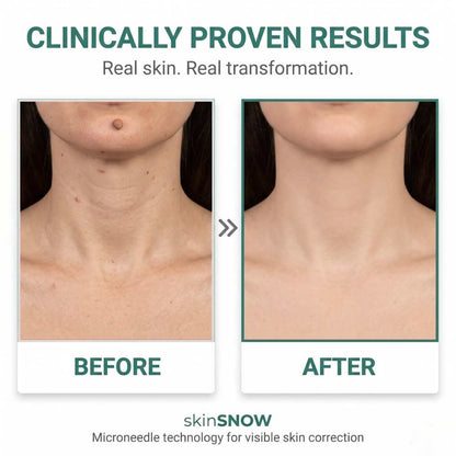 SkinSNOW - Patches For Skin